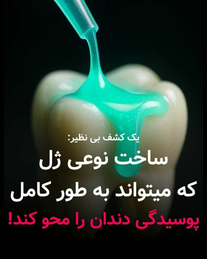 ساخت نوعی ژل که می تواند به طور کامل پوسیدگی دندان را محو کند